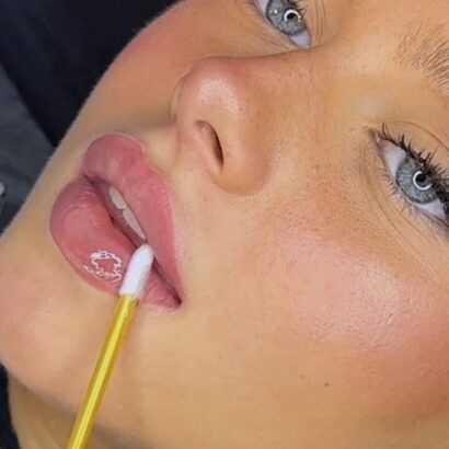 Lara Aesthetics Hannover