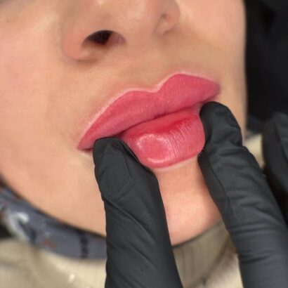 Lara Aesthetics Hannover